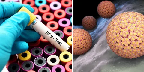 HPV Tedavi Süreci Ne Kadar Sürer